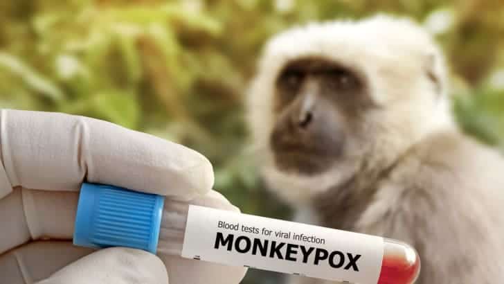 Airport Checks Begin as 13 Mpox Cases Hit Singapore